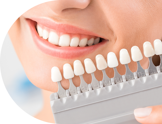 teeth Whitening in Knoxville