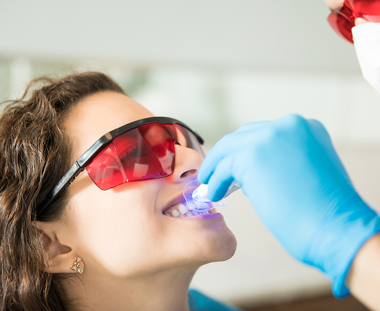 What Makes Our Teeth Whitening Special?