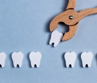 What-to-Do-Before-a-Tooth-Extraction-in-Knoxville-A-Stress-Free-Checklist