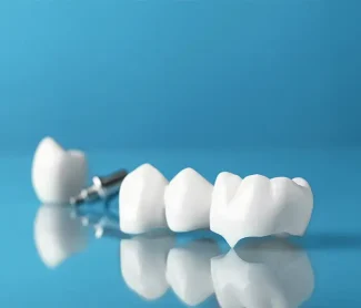 dental crown in Knoxville, TN, dental crown near you